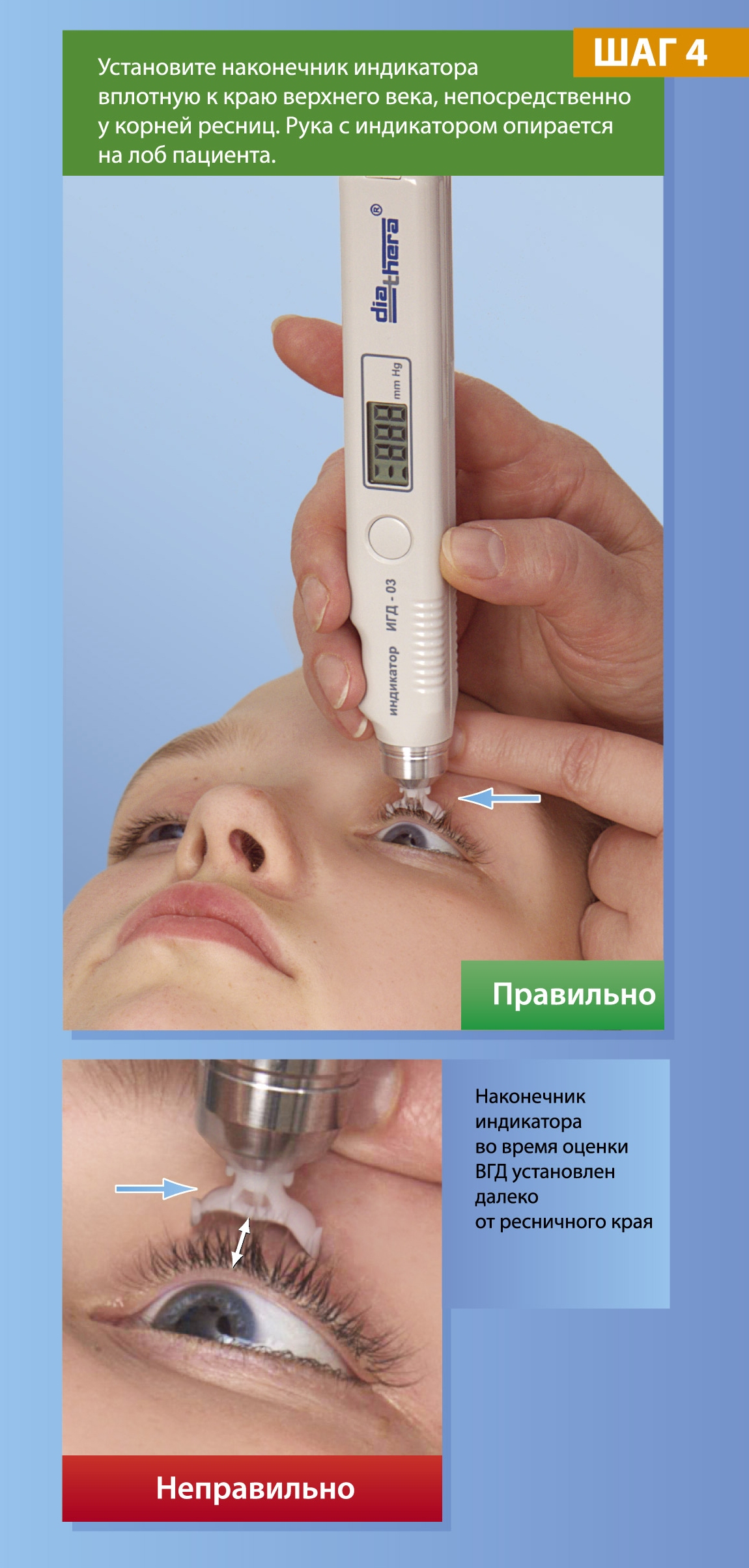 Измерение ВГД в одно касание! Новинка! ИГД-03 diathera